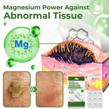 🔥Final 3 Hours: 80% OFF - CQGCQGQ® Magnesium MicroNeedle Quick Remove Skin Tag Patches
