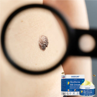 🔥Final 3 Hours: 80% OFF - ODEIUN® BeeDerm RX Cream, Painless, Targeted Treatment for Warts, Skin Tags, Skin Lesions, Infections, Cysts, and Scars💛