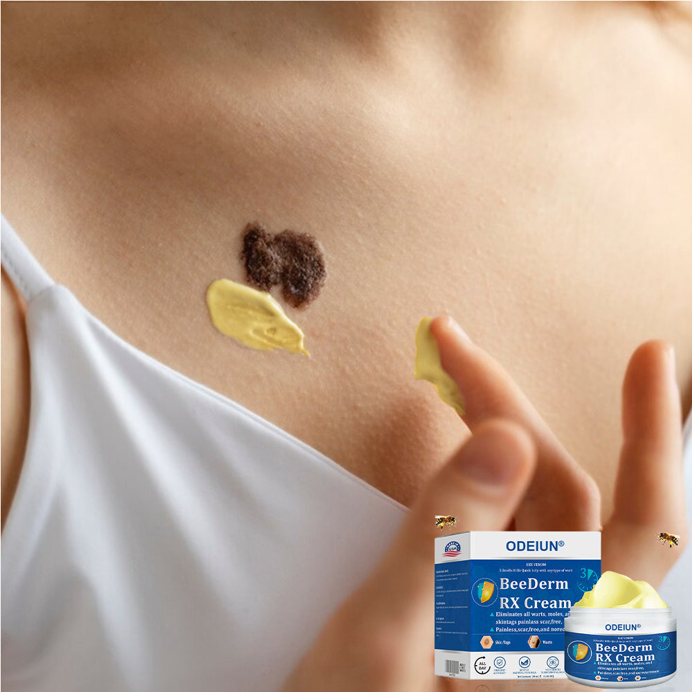 🔥Final 3 Hours: 80% OFF - ODEIUN® BeeDerm RX Cream, Painless, Targeted Treatment for Warts, Skin Tags, Skin Lesions, Infections, Cysts, and Scars💛