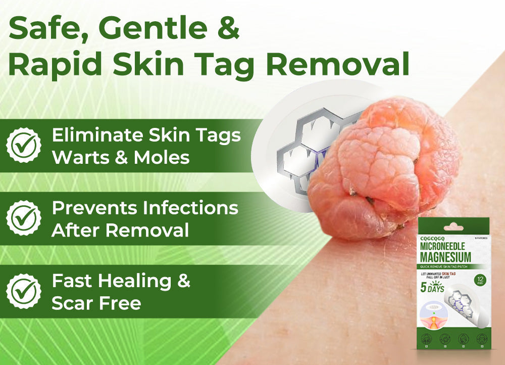🔥Final 3 Hours: 80% OFF - CQGCQGQ® Magnesium MicroNeedle Quick Remove Skin Tag Patches