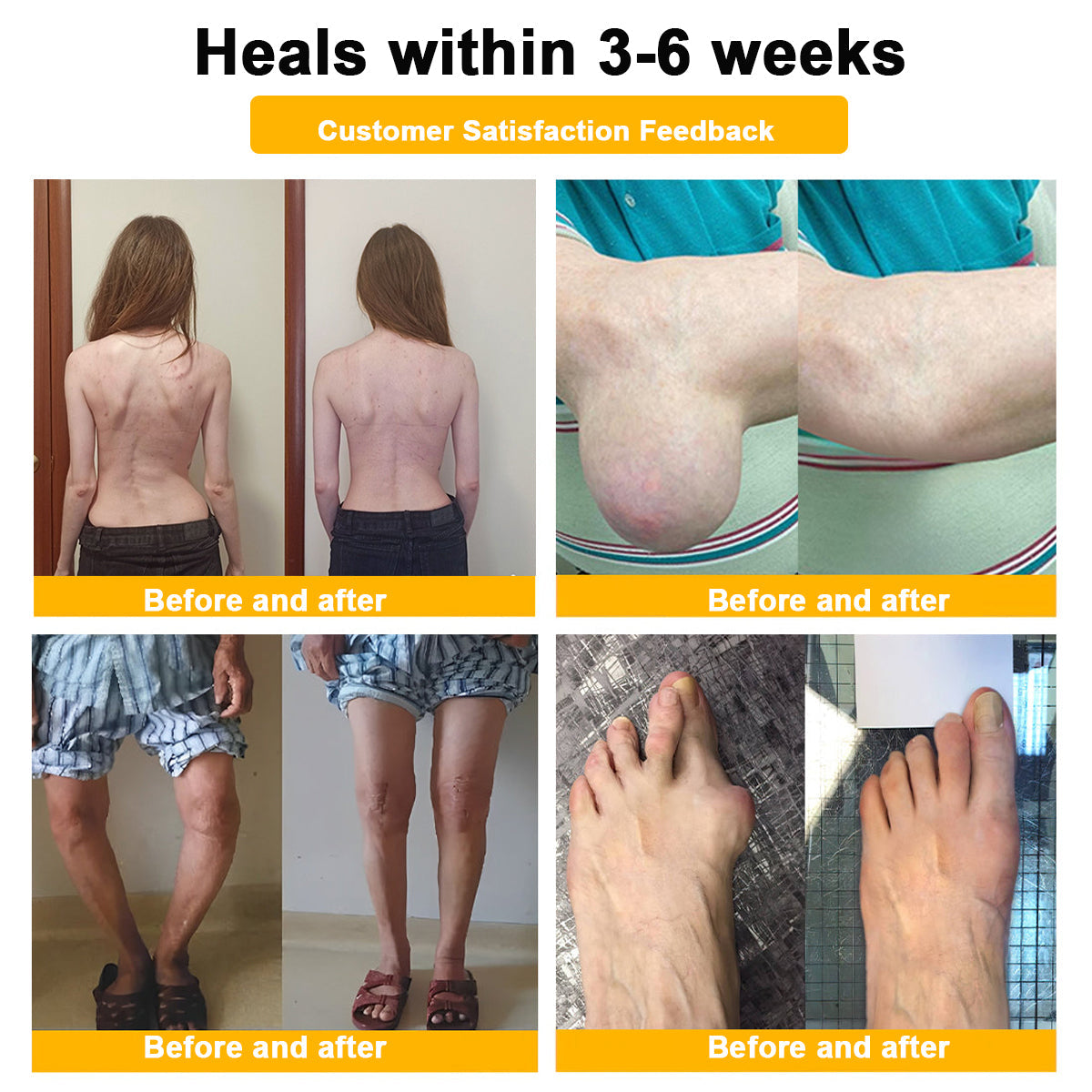 🔥Final 3 Hours: 80% OFF - ODEIUN™ Turmeric & Bee Venom Joint and Bone Pain Relief Cream🐝