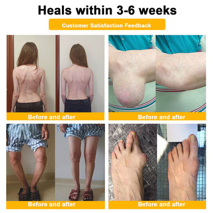 🔥Final 3 Hours: 80% OFF - ODEIUN™ Turmeric & Bee Venom Joint and Bone Pain Relief Cream🐝