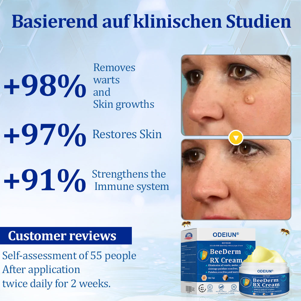 🔥Final 3 Hours: 80% OFF - ODEIUN® BeeDerm RX Cream, Painless, Targeted Treatment for Warts, Skin Tags, Skin Lesions, Infections, Cysts, and Scars💛