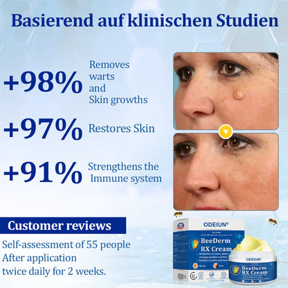 🔥Final 3 Hours: 80% OFF - ODEIUN® BeeDerm RX Cream, Painless, Targeted Treatment for Warts, Skin Tags, Skin Lesions, Infections, Cysts, and Scars💛