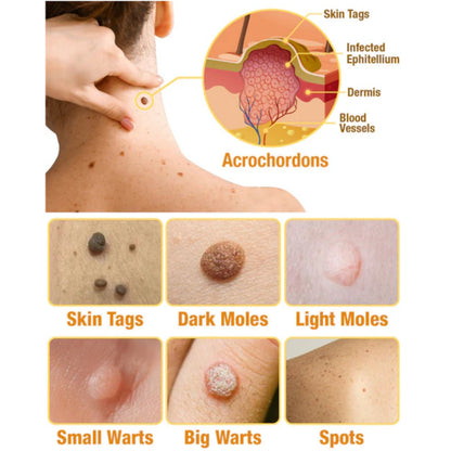 🔥Final 3 Hours: 80% OFF - LBMLBM™ TagRecede Bee Venom Treatment Spray