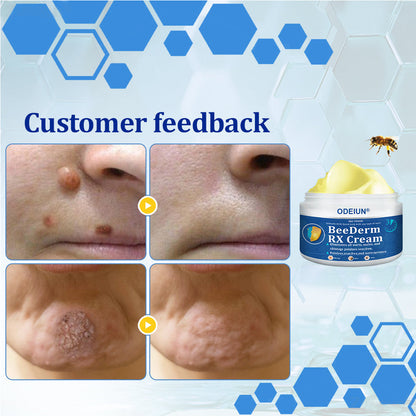 🔥Final 3 Hours: 80% OFF - ODEIUN® BeeDerm RX Cream, Painless, Targeted Treatment for Warts, Skin Tags, Skin Lesions, Infections, Cysts, and Scars💛