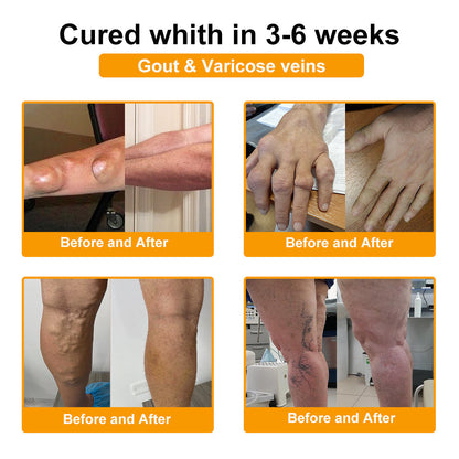 🔥Final 3 Hours: 80% OFF - SEURICO™ Bee Venom Pain Relief Bone Soothing Cream🐝