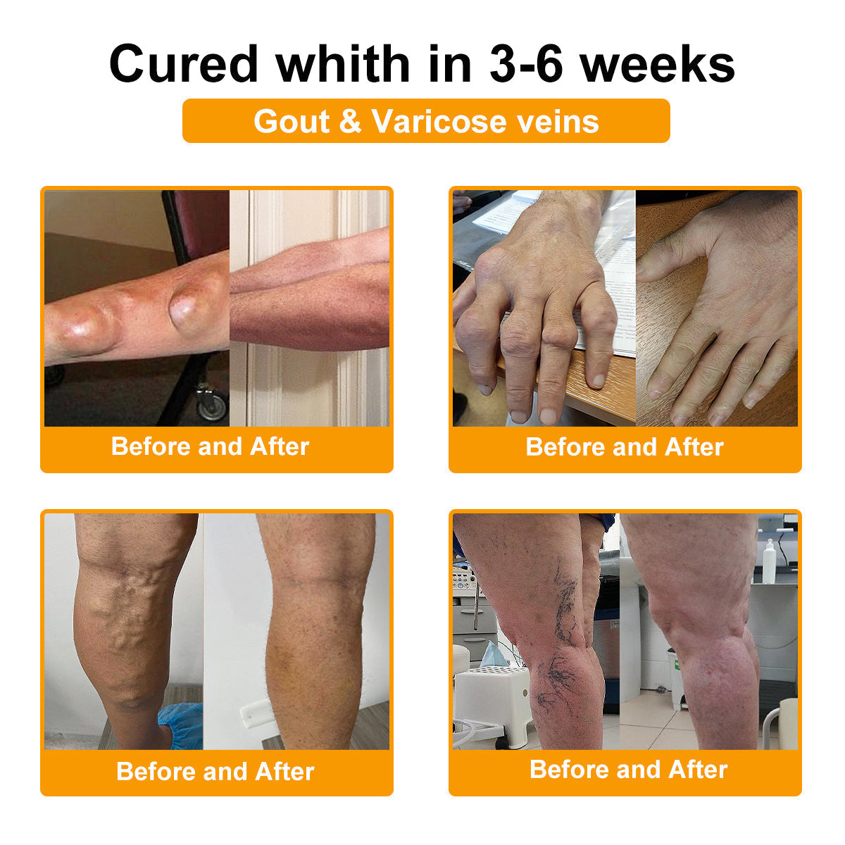 🔥Final 3 Hours: 80% OFF - ODEIUN™ Turmeric & Bee Venom Joint and Bone Pain Relief Cream🐝