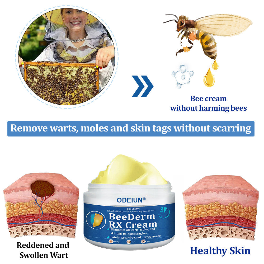 🔥Final 3 Hours: 80% OFF - ODEIUN® BeeDerm RX Cream, Painless, Targeted Treatment for Warts, Skin Tags, Skin Lesions, Infections, Cysts, and Scars💛