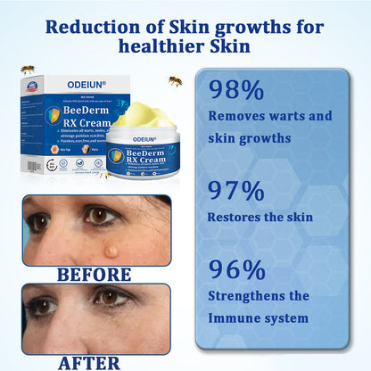 🔥Final 3 Hours: 80% OFF - ODEIUN® BeeDerm RX Cream, Painless, Targeted Treatment for Warts, Skin Tags, Skin Lesions, Infections, Cysts, and Scars💛