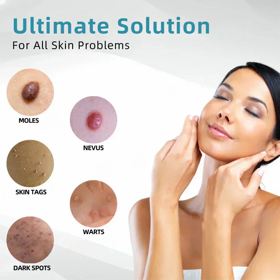 🔥Final 3 Hours: 80% OFF - ODALIT® All-in-One CO₂ Laser Eraser Pen | Removes Moles, Warts, Skin Flaws & Pigmentation