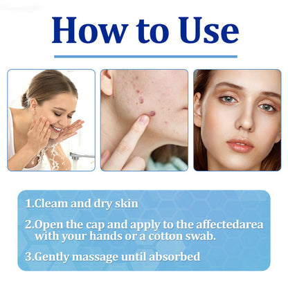 🔥Final 3 Hours: 80% OFF - ODEIUN® BeeDerm RX Cream, Painless, Targeted Treatment for Warts, Skin Tags, Skin Lesions, Infections, Cysts, and Scars💛