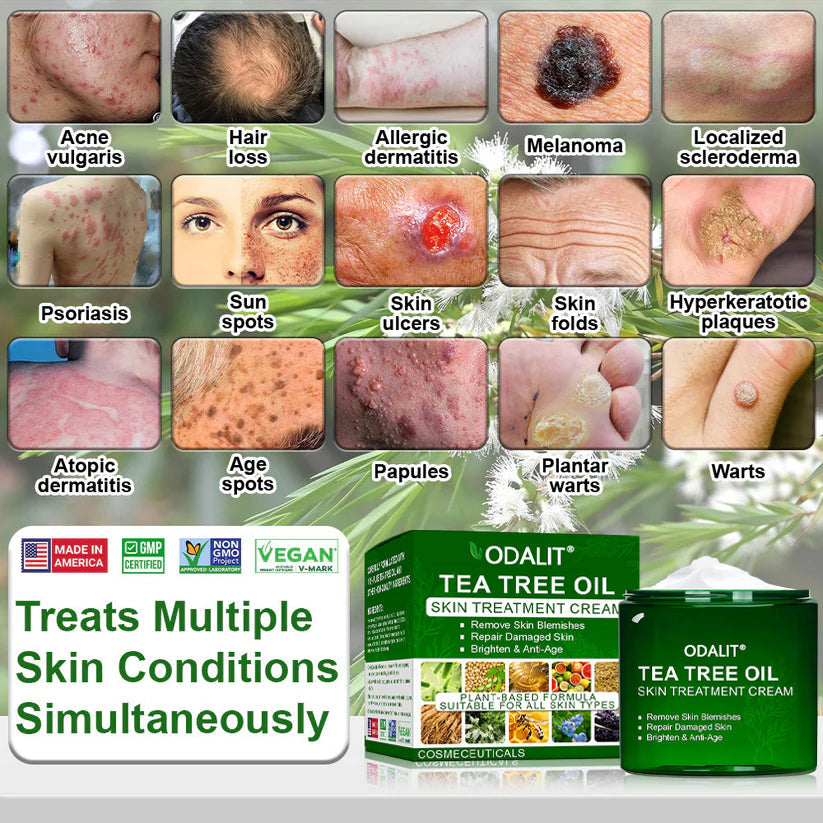 🌿ODALIT® Tea Tree Oil Skin Treatment Cream