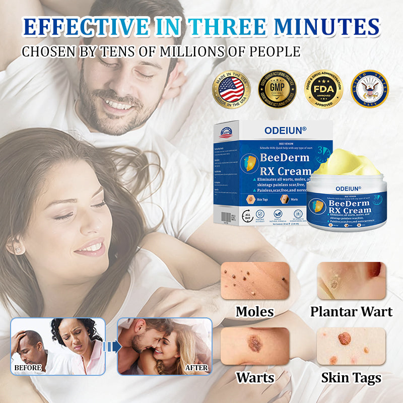 🔥Final 3 Hours: 80% OFF - ODEIUN® BeeDerm RX Cream, Painless, Targeted Treatment for Warts, Skin Tags, Skin Lesions, Infections, Cysts, and Scars💛