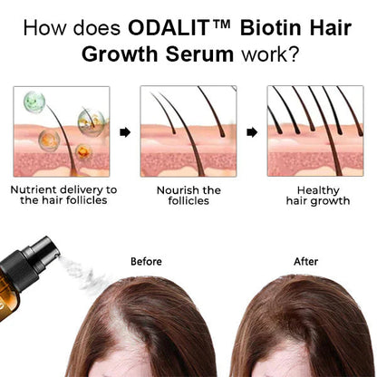 ODALIT™ Biotin Hair Growth Serum