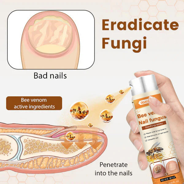 🔥Final 3 Hours: 80% OFF - ODALIT™ Bee Venom Nail Fungus Soothing Spray 🐝