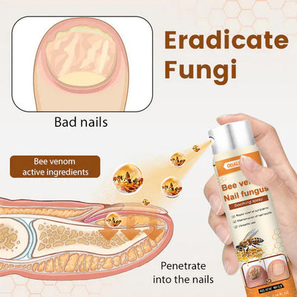 🔥Final 3 Hours: 80% OFF - ODALIT™ Bee Venom Nail Fungus Soothing Spray 🐝