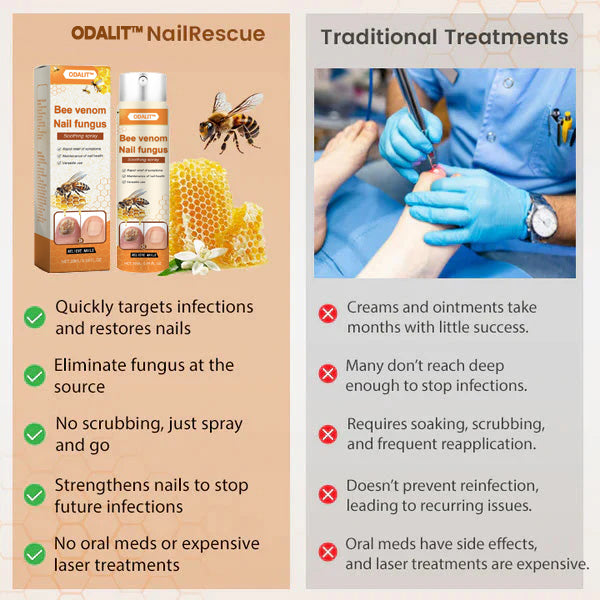 🔥Final 3 Hours: 80% OFF - ODALIT™ Bee Venom Nail Fungus Soothing Spray 🐝