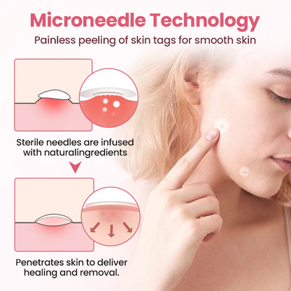 ODEIUN® Painless Micro Wart Removal Patch