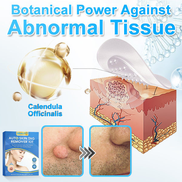 🔥Final 3 Hours: 80% OFF - ODALIT™ Auto Skin Tag Remover Kit 🇺🇸 Made in the USA👨‍⚕️