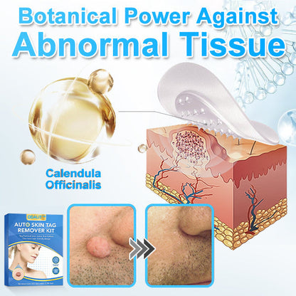 🔥Final 3 Hours: 80% OFF - ODALIT™ Auto Skin Tag Remover Kit 🇺🇸 Made in the USA👨‍⚕️