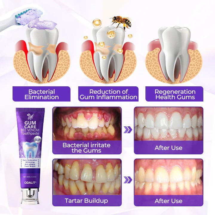🔥Final 3 Hours: 80% OFF - 🐝ODALIT® Bee Venom Gum Care Toothpaste🦷