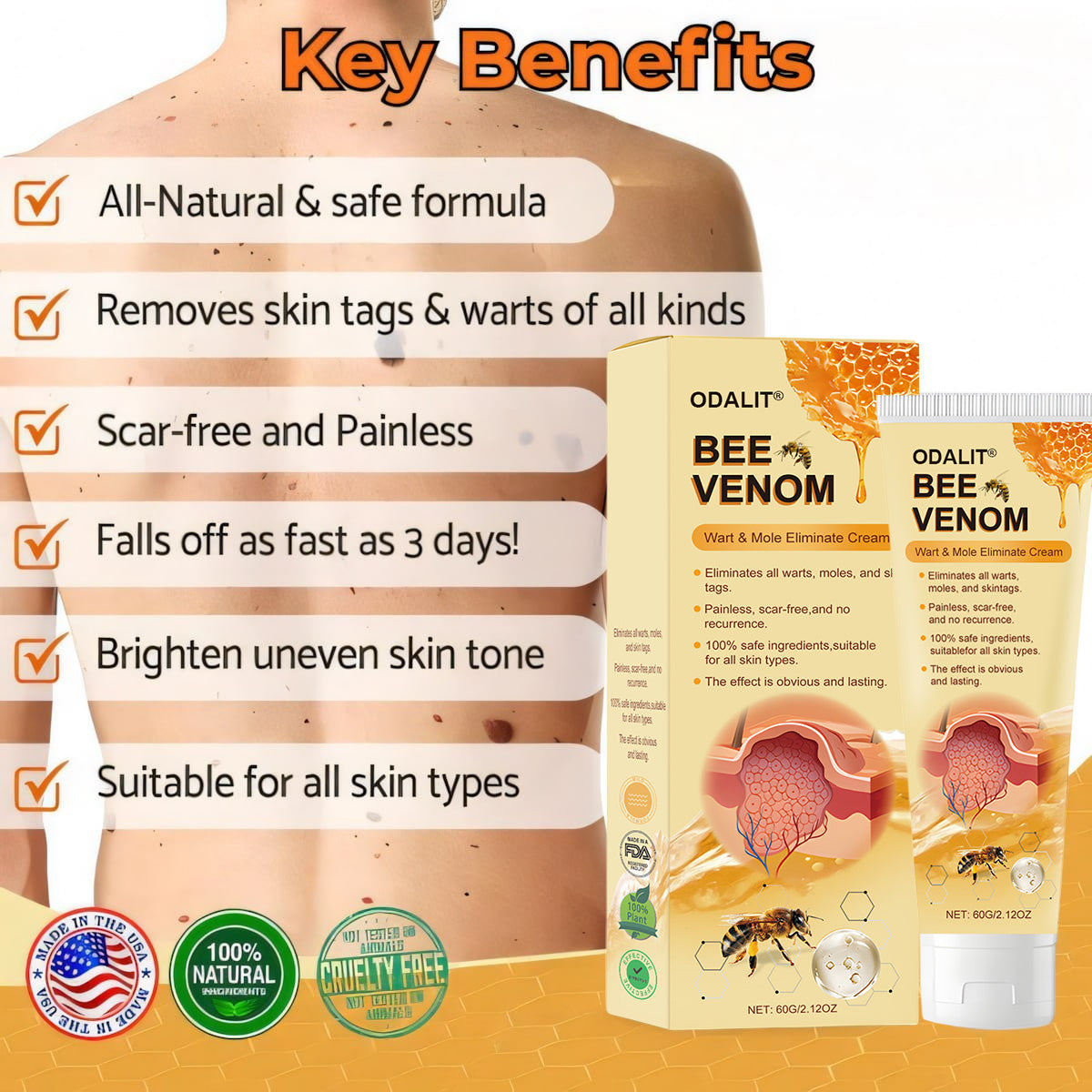 ODALIT® Bee Venom Wart & Mole Eliminate Cream