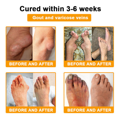 🔥Final 3 Hours: 80% OFF - ODEIUN™ Turmeric & Bee Venom Joint and Bone Pain Relief Cream🐝