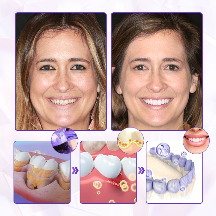 🔥Final 3 Hours: 80% OFF - 🐝ODALIT® Bee Venom Gum Care Toothpaste🦷