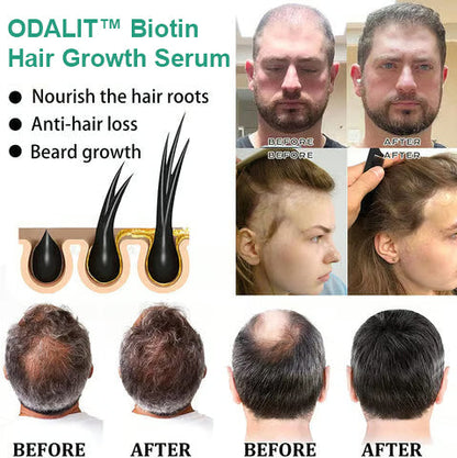 ODALIT™ Biotin Hair Growth Serum