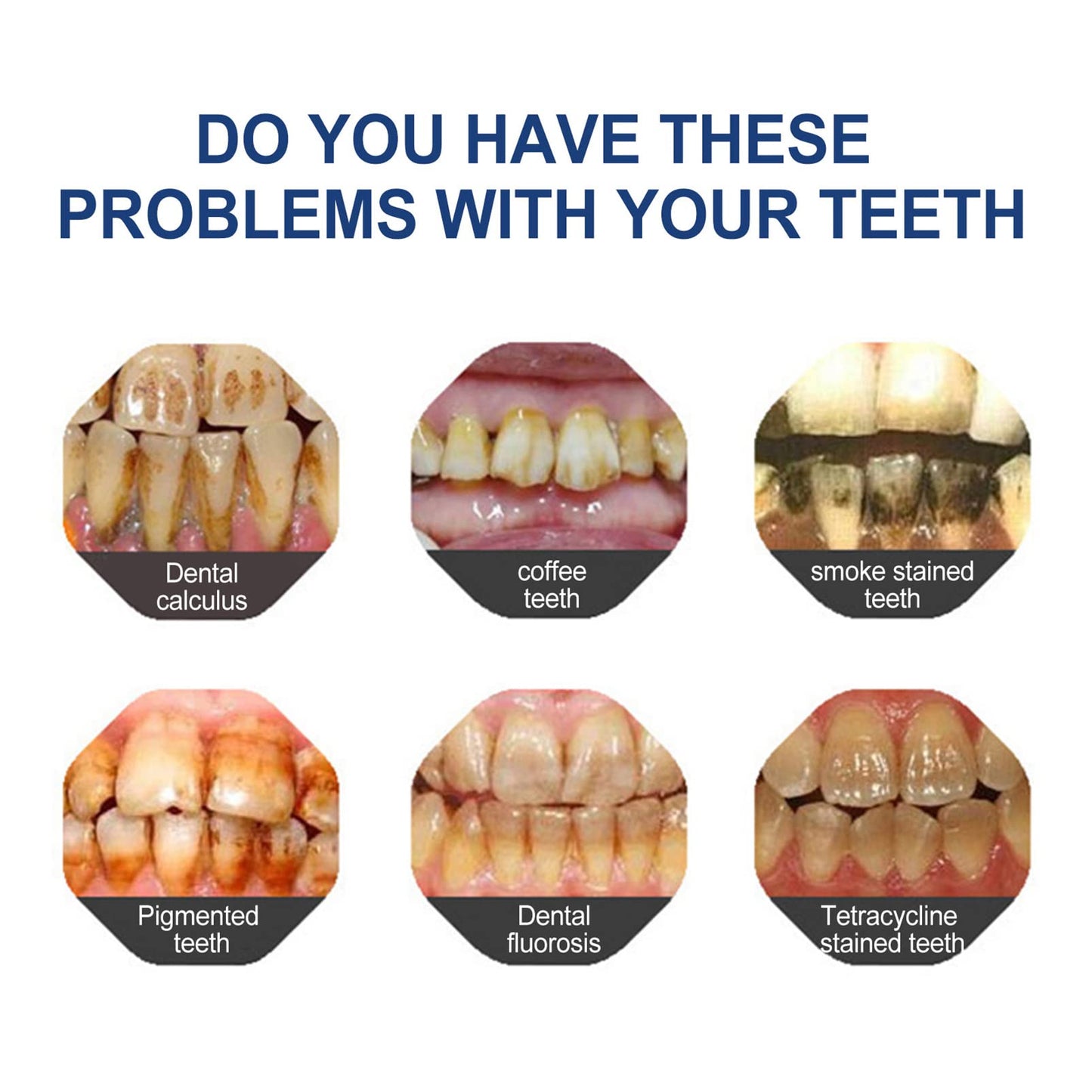 🔥Time-Limited Offer -🦷ODALIT™ Fluoride-Free Nano-Hydroxyapatite Toothpaste