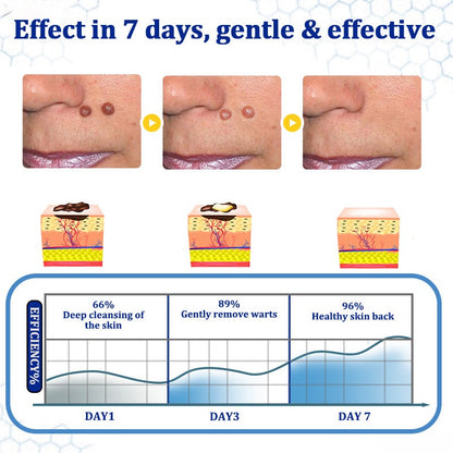 🔥Final 3 Hours: 80% OFF - ODEIUN® BeeDerm RX Cream, Painless, Targeted Treatment for Warts, Skin Tags, Skin Lesions, Infections, Cysts, and Scars💛