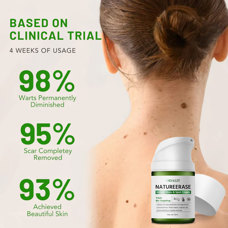 🔥Final 3 Hours: 80% OFF - ODALIT™ NatureErase Instant Mole & Spot Cream