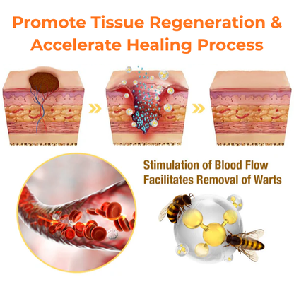 ODALIT® Bee Venom Wart & Mole Eliminate Cream