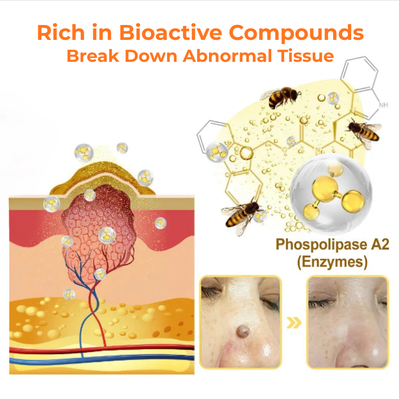 ODALIT® Bee Venom Wart & Mole Eliminate Cream