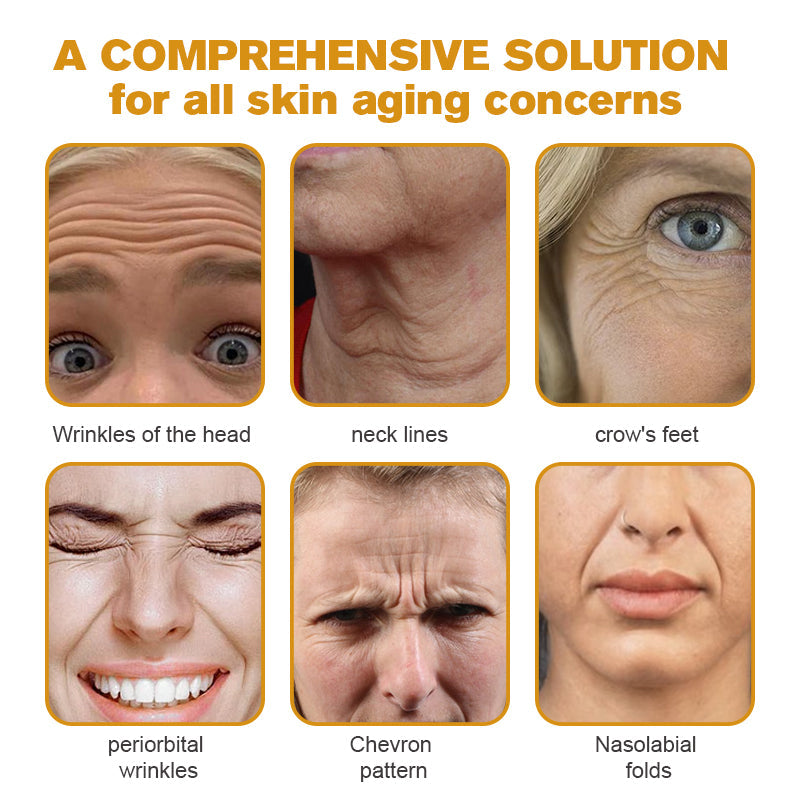 🔥Final 3 Hours: 80% OFF - ODALIT™ Botox Bee Venom Wrinkle Removal Cream🐝