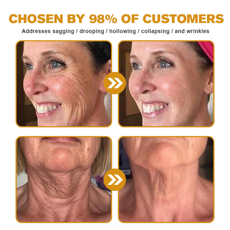 🔥Final 3 Hours: 80% OFF - ODALIT™ Botox Bee Venom Wrinkle Removal Cream🐝