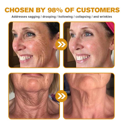 🔥Final 3 Hours: 80% OFF - ODALIT™ Botox Bee Venom Wrinkle Removal Cream🐝
