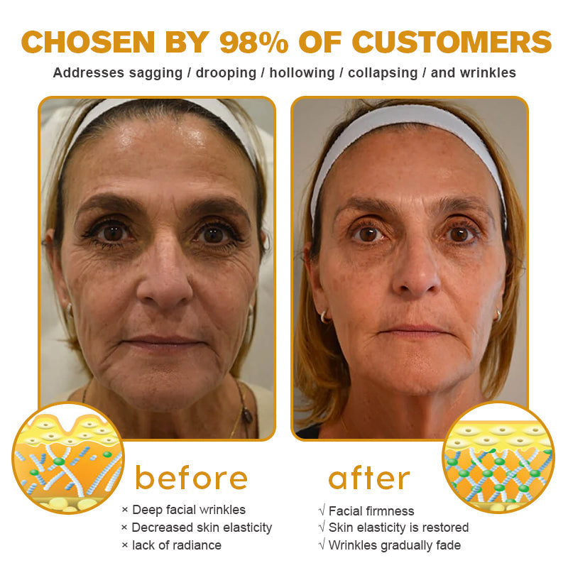 🔥Final 3 Hours: 80% OFF - ODALIT™ Botox Bee Venom Wrinkle Removal Cream🐝
