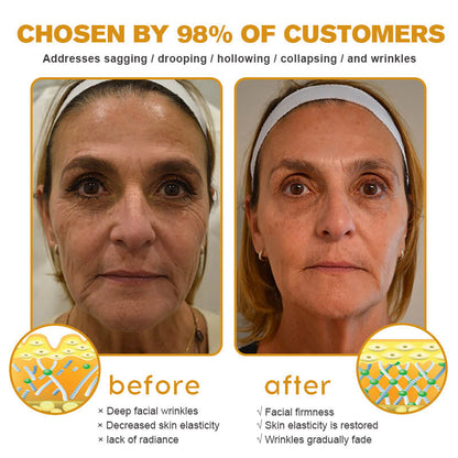 🔥Final 3 Hours: 80% OFF - ODALIT™ Botox Bee Venom Wrinkle Removal Cream🐝